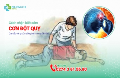 Cách nhận biết sớm cơn đột quỵ