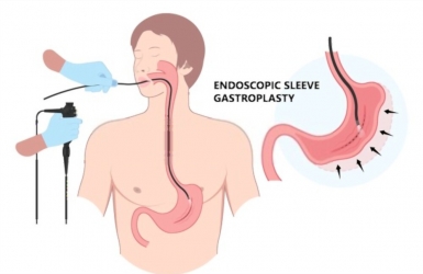 Nội soi dạ dày: Phương pháp thăm khám và can thiệp điều trị đường tiêu hóa hiệu quả nhất hiện nay