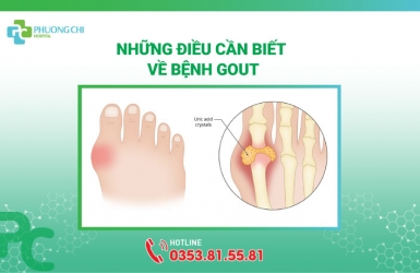 Những Điều Cần Biết Về Bệnh Gout