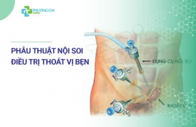 Tìm hiểu về phẫu thuật nội soi điều trị thoát vị bẹn