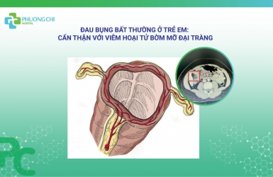 Đau Bụng Bất Thường Ở Trẻ Em: Cẩn Thận Với Viêm Hoại Tử Bờm Mỡ Đại Tràng