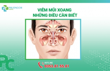 Viêm Mũi Xoang: Những Điều Cần Biết